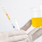 Cara Membaca Hasil Tes Urin Laboratorium Panduan Lengkap Untuk Memahami Kesehatan Anda