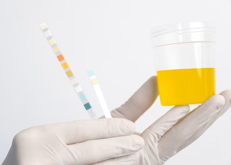 Cara Membaca Hasil Tes Urin Laboratorium Panduan Lengkap Untuk Memahami Kesehatan Anda