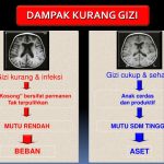 Dampak Kurang Gizi Pada Kinerja Organ Dalam Ancaman Tersembunyi Bagi Kesehatan Tubuh