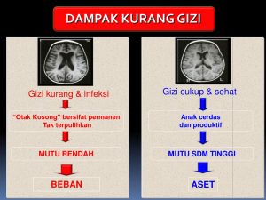 Dampak Kurang Gizi Pada Kinerja Organ Dalam Ancaman Tersembunyi Bagi Kesehatan Tubuh