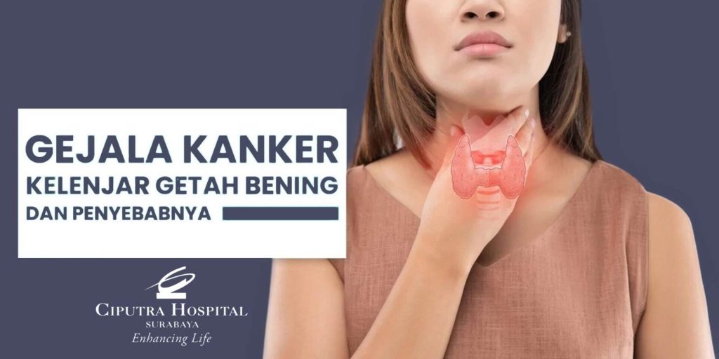 Memahami Gejala Kanker Getah Bening Yang Sering Terabaikan Sebuah Panduan Komprehensif