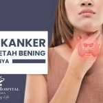 Memahami Gejala Kanker Getah Bening Yang Sering Terabaikan Sebuah Panduan Komprehensif