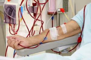 Mengenal Prosedur Cuci Darah Hemodialisa