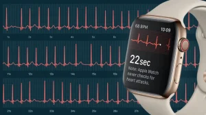 Apakah Fitur Ecg Di Apple Watch Series 9 Akurat Untuk Deteksi Fibrilasi Atrium