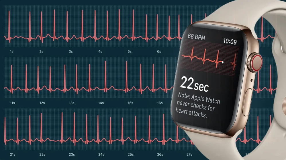 Apakah Fitur Ecg Di Apple Watch Series 9 Akurat Untuk Deteksi Fibrilasi Atrium